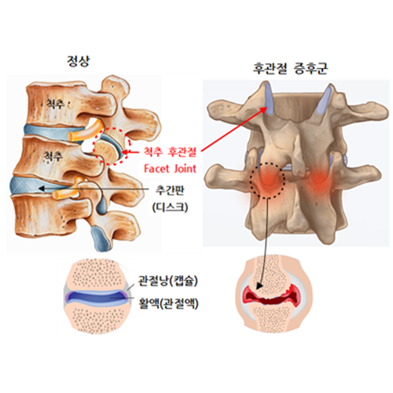 서현탑정형외과