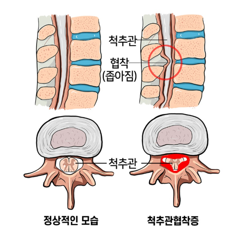 서현탑정형외과