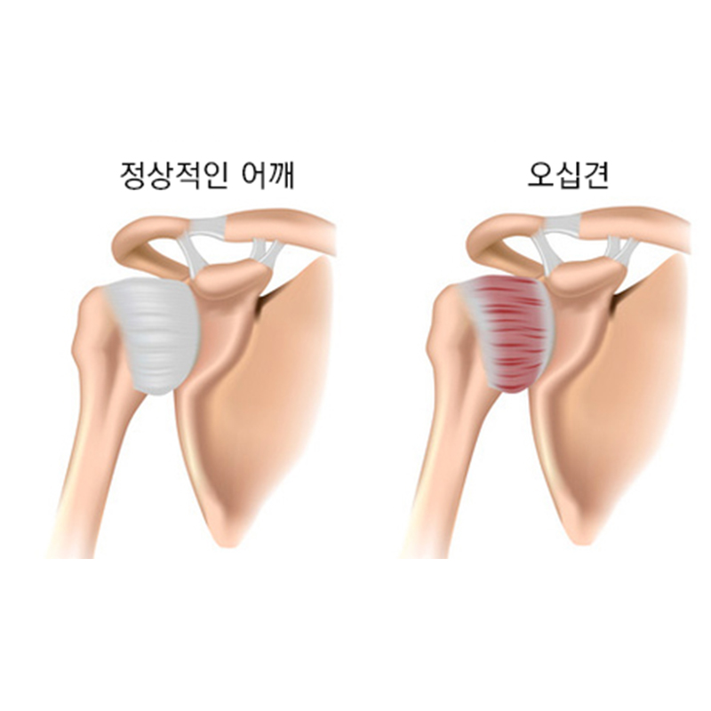 서현탑정형외과