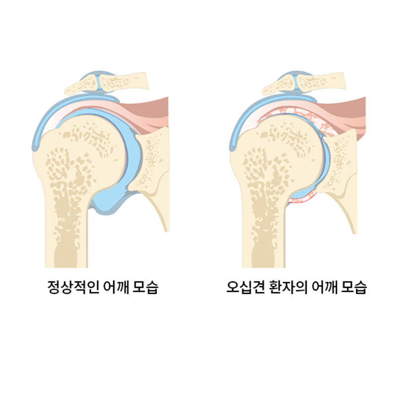 서현탑정형외과