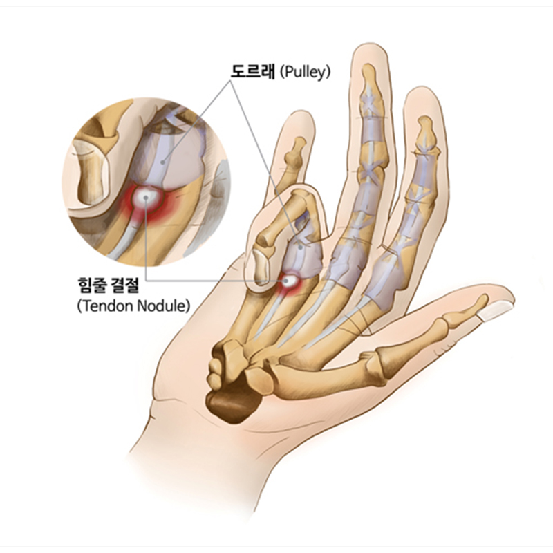서현탑정형외과