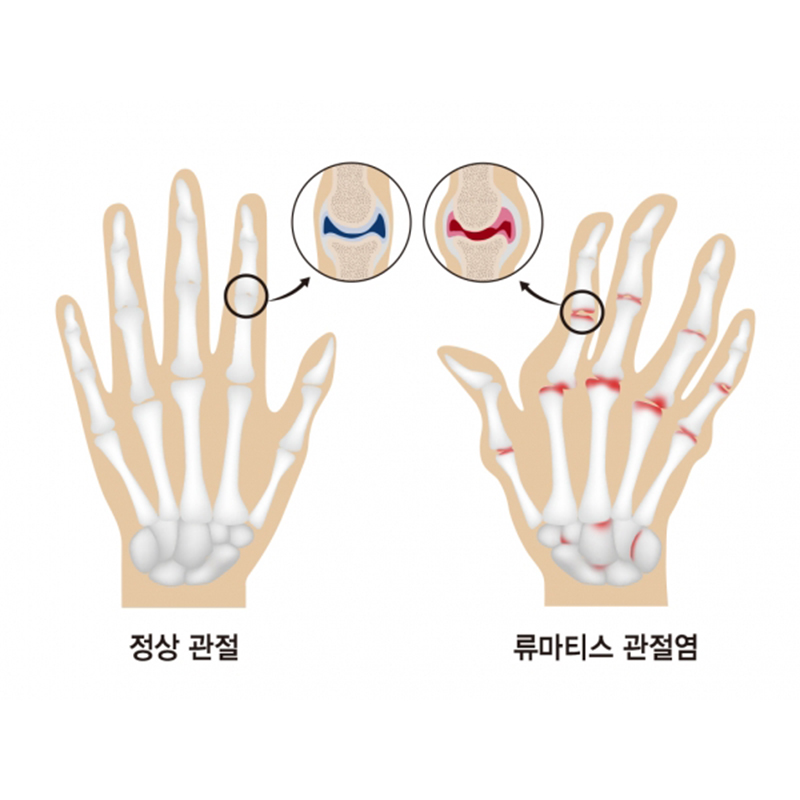 서현탑정형외과