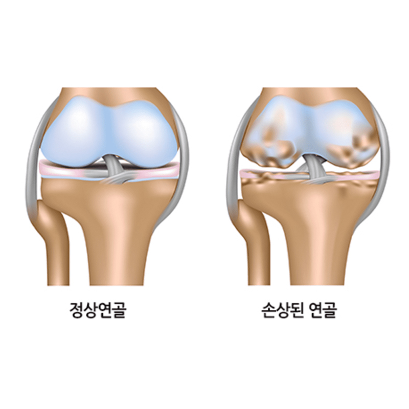서현탑정형외과