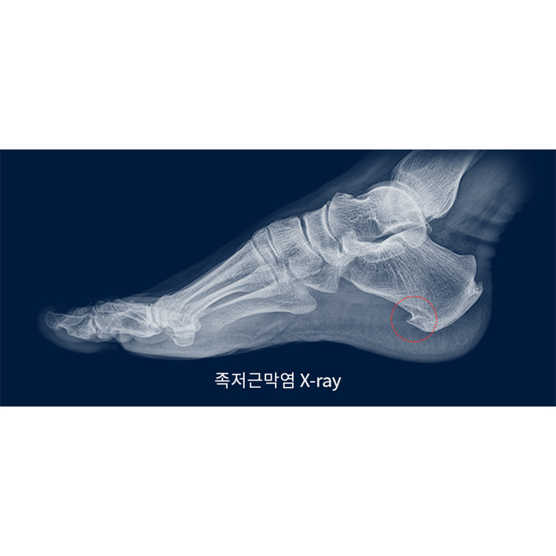 서현탑정형외과