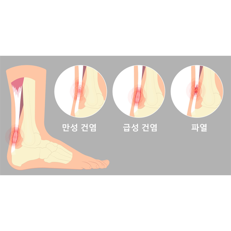 서현탑정형외과